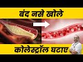 कोलेस्ट्रॉल कैसे कम करें जानिए | How to Reduce Cholesterol Naturally Home Remedies | Heart Attacks