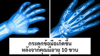 24 สิ่งที่บ่งบอกว่าร่างกายของคุณมีความพิเศษจริงๆ