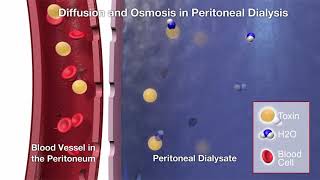 Satellite Healthcare | PD | Diffusion & Osmosis | 3D Animation
