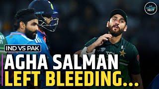 Asia Cup 2023, IND vs PAK: Agha Salman Left Bleeding After Taking a Nasty Blow on His Face