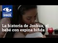 La historia de Joshua, el bebé con espina bífida que fue operado dentro del vientre de su madre