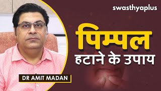 पिम्पल से कैसे पाएं छुटकारा? | How to Remove Pimples in Hindi | Dr Amit Madan