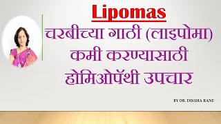 Lipomas | चरबीच्या गाठी (लाइपोमा) कमी करण्यासाठी होमिओपॅथी उपचार