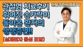 관절염치료후기 휘어진 손가락이 돌아온 환자의 생생증언