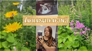 Tuleeko meille toinen lapsi? 👶 Varhaisultra ✨ || VLOG