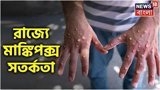 Monkey Pox Alert | West Bengal | রাজ্যে মাঙ্কি পক্সের সতর্কতা, জারি বিজ্ঞপ্তি | Bangla News |