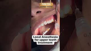 Local Anesthesia For Upper Teeth Treatment || Happy Smiles Dental Care || #shorts