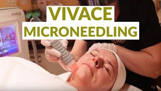 Vivace Microneedling with RF Rejuv Cosmetic Center NJ