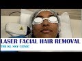 PAINLESS LASER FACIAL HAIR REMOVAL