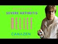 Canazen Cannabis Cream Testimonial | Reduces the pain of severe arthritis for Marilyn