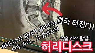 허리디스크 수술받은 환자가 직접 들려주는 수술후기 [추간판탈출증수술후기] 대전본병원