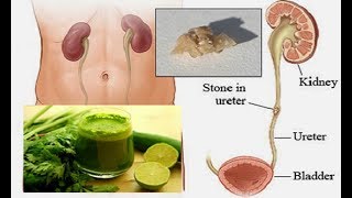 মাত্র ৫ টাকায় কিডনি পরিস্কার জেনে নিন কিভাবে ? Health Tips Bangla
