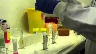 How Do You Process a Bloody Sample? | Francesca Albertini