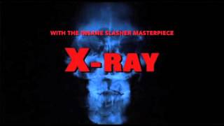 Cinematic Void Vol. 1: X-RAY (HOSPITAL MASSACRE)