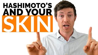 15 Skin Conditions CAUSED by Hashimoto's