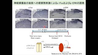 顎顔面解剖学