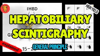 Hebatobiliary Scintigraphy Explained (HIDA scan)