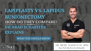 Lapiplasty Vs. Lapidus Bunionectomy: Which One Is Better?