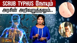 SCRUB TYPHYS நோயும்! அரசின் அறிவுறுத்தலும்... | Scrub Typhus Bacteria | TNGovt | Precautions