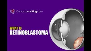 What is Retinoblastoma and Retinal Cancer?