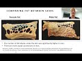 a new theory lipedema is caused by subclinical compartment syndrome dr. karen herbst