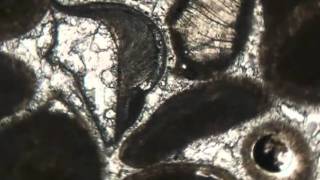 Brachiopod in oolitic grainstone (PPL)