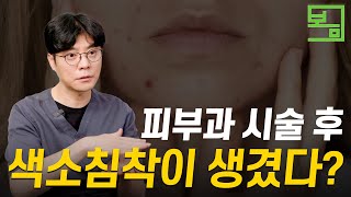 피부과 시술 후 생긴 색소침착, 치료할 수 있을까?