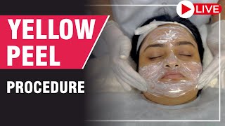 Yellow Peels - Step by Step | Peeling Treatment for Skinglow and Acne scars @sakhiyaskinclinic