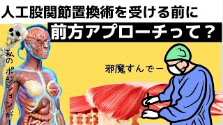 人工股間節置換術を受ける前に「前方アプローチ」って何？