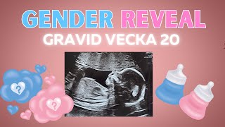 GENDER REVEAL, GRAVID VECKA 20