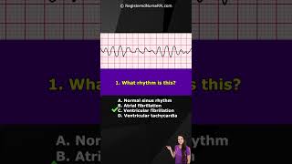 Ecg Rhythm Pop Quiz Can You Identify These Ekg Rhythms Shorts
