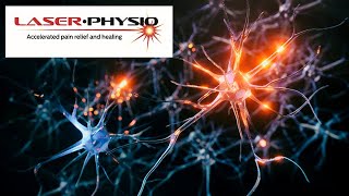 Laser Contraindications Explained 5 Epilepsy   20230802 112116