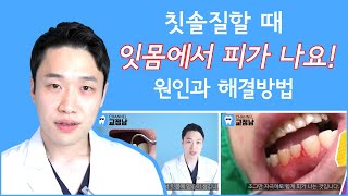 칫솔질할 때 잇몸에서 피가 나요, 양치질 시 잇몸출혈의 이유와 해결법, 잇몸병을 예방하는 치아건강상식!