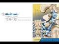 Medtronic:TSRH 3D Spondylolisthesis Corrected