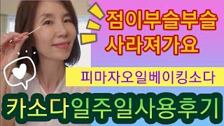 피마자오일과베이킹소다일주일사용후기,점이부슬부슬떨어져갑니다