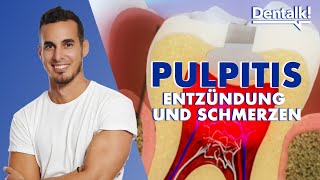 Zahnschmerzen? Es könnte sich um PULPITIS handeln – Ursachen und die Behandlung | Dentalk! ©