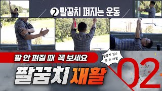 팔꿈치 안 펴질때, 재활 운동법, (팔꿈치 골절 깁스 후 재활 #2)