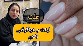 علت لیفت و هواگیری ناخن