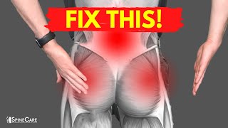 How to Fix Muscle Knots in Your Lower Back and Hips
