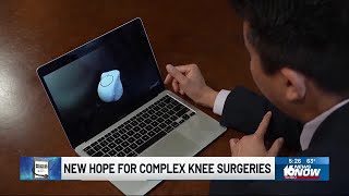 Medical Moment: New hope for complex knee surgeries