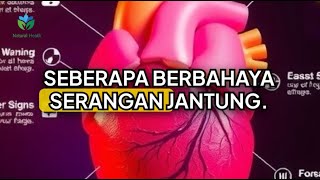 Bahaya Serangan Jantung: Penyebab dan Fakta yang Mengejutkan!\