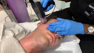 KEEP YOUR JAWLINE SNATCHED AND SKIN TIGHT WITH MORPHEUS 8 DEEP MICRONEEDLING RF | Dr. Jason Emer