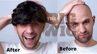 Full Wigs For Male In India | Chemo Wigs | Alopecia Wigs | Wig caps