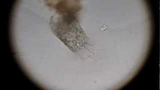 Another transparent hypotrich (Stylonychia)