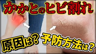 【かかと ひび割れ】クリームを塗っても一向に良くならないひび割れはどうすればいい？【足指ほぐし】