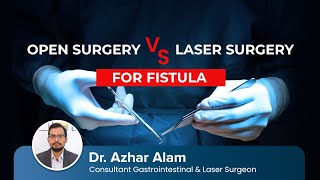 Open Surgery vs Laser Surgery for Anal Fistula | Dr Azhar Alam