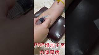 PRP增加子宮內膜的厚度！這樣做！