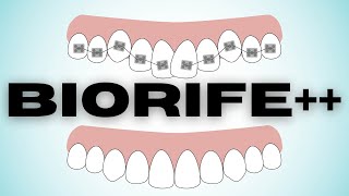 Get Perfectly Straight Teeth!!100%GUARANTEED!![BIORIFE++Audio Subls]―∎ Teeth Aligning Frequencies!!