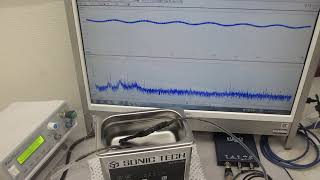 １００ＭＨｚ以上の超音波伝搬状態を利用可能にする超音波発振制御技術ーー超音波洗浄器（42kHz　35W）実験ーー（超音波システム研究所）