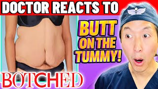 Plastic Surgeon Reacts to BOTCHED: A BUTT On Her TUMMY!
